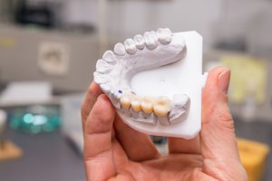 Photograph of a person holding a model dental prothetic in a dentist office setting.