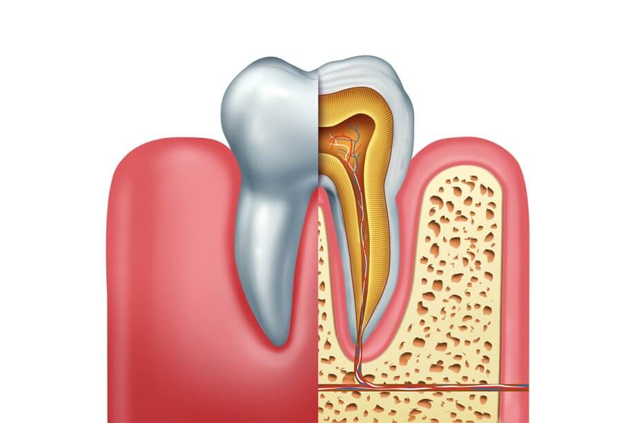 How Do You Know If You Need A Root Canal?