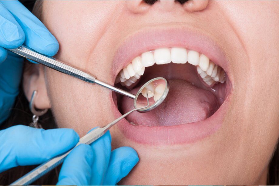 A dentist holds dental tools by patient's mouth