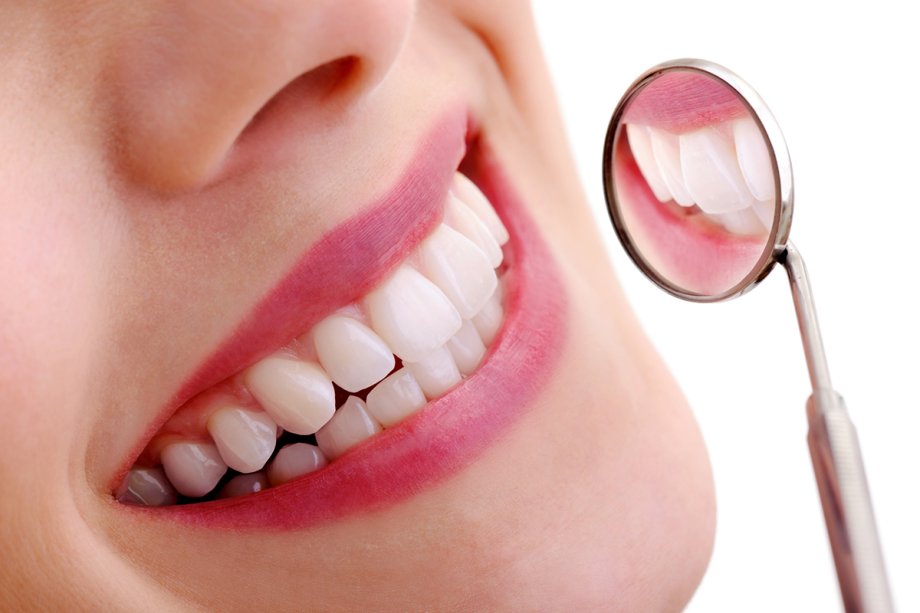 How Long Does Teeth Whitening Typically Last?