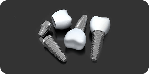 Dental Implants in Aurora, OH